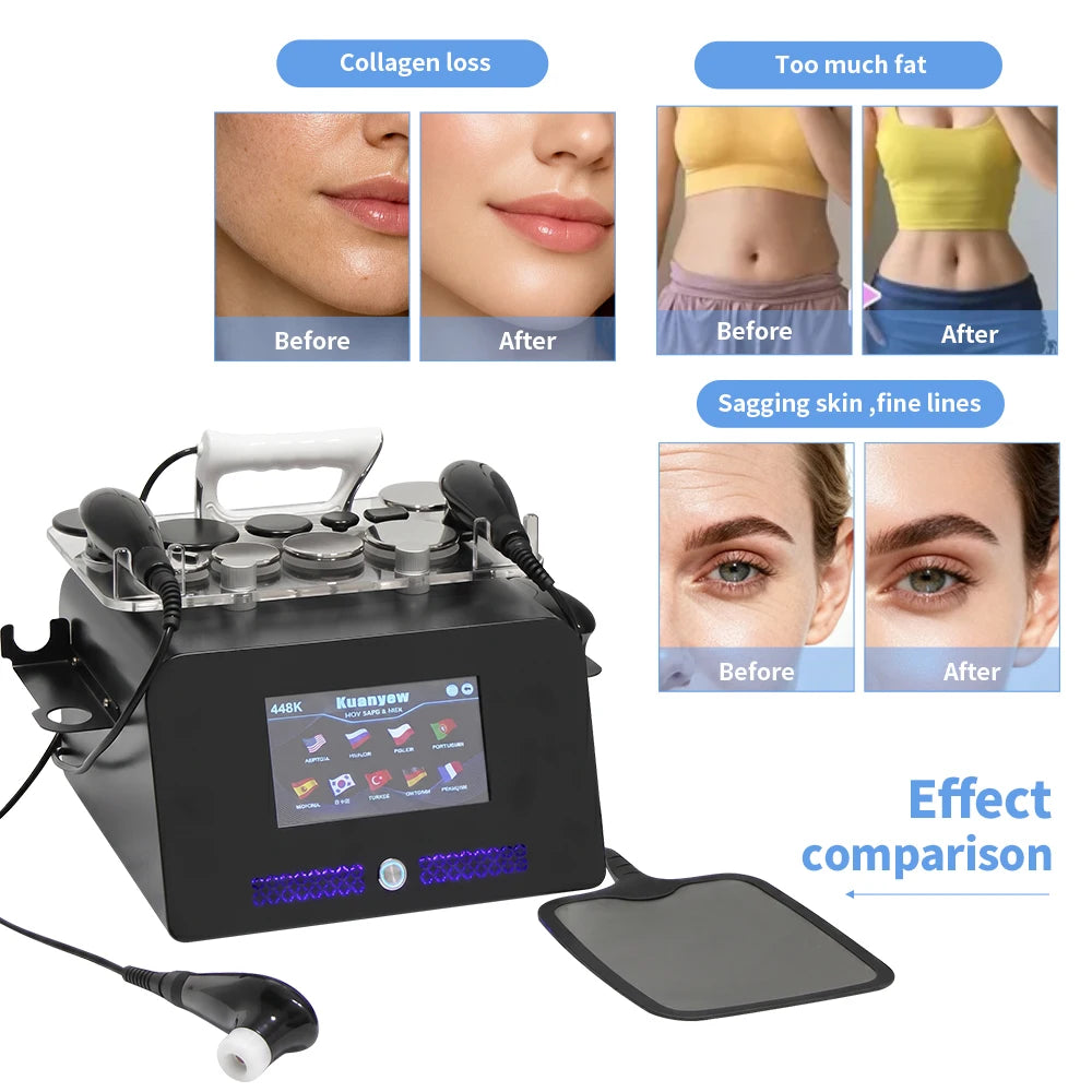 YUET WIN Tecar Therapy Device For Skin Tightening And Rejuvenation