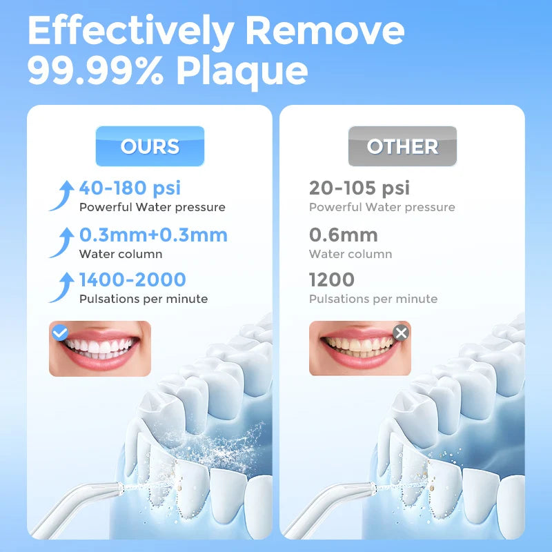 Sejoy Cordless Electric Oral Irrigator For Effective Dental Cleaning