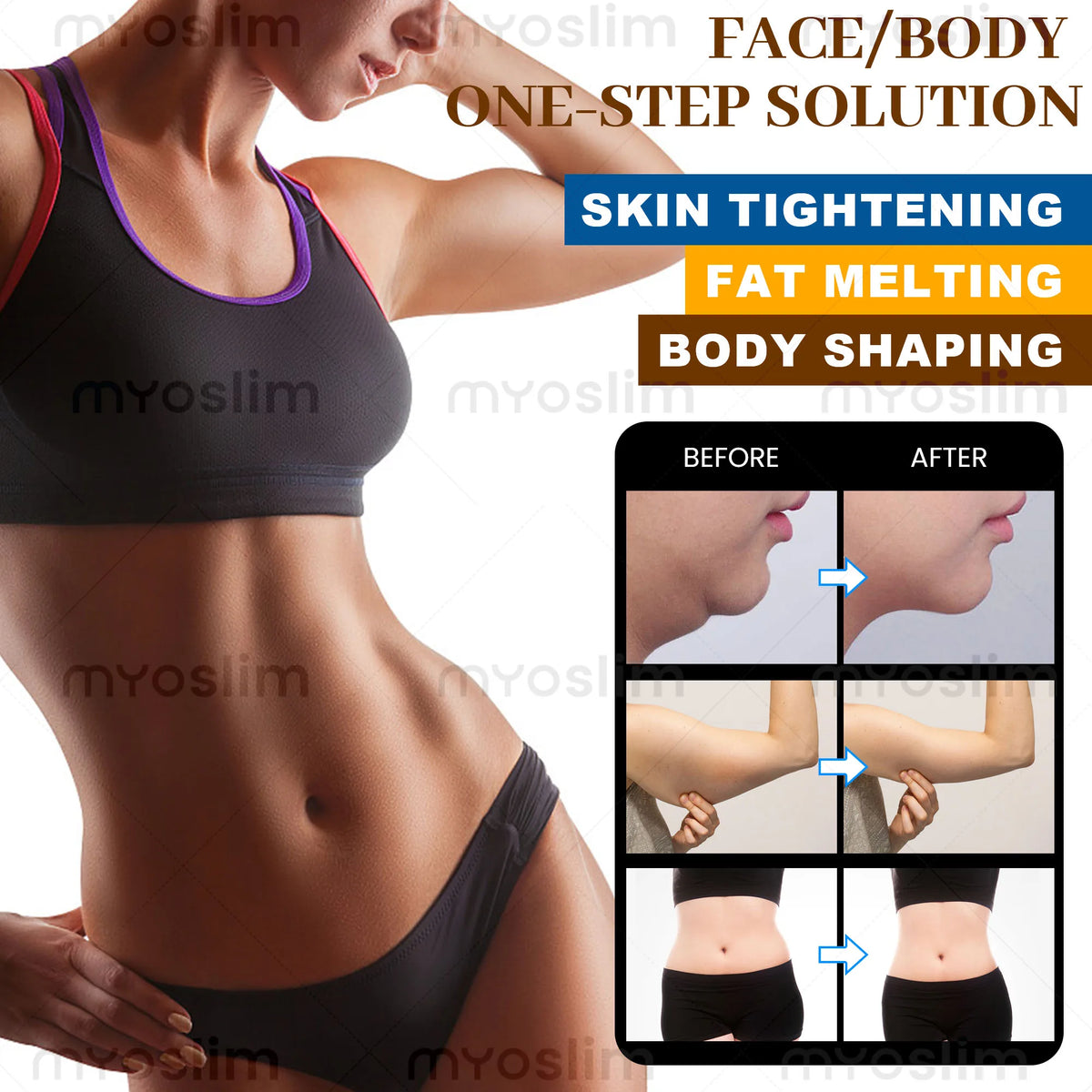 MYOSLIM Cryolipolysis Body Sculpting and Skin Tightening Machine
